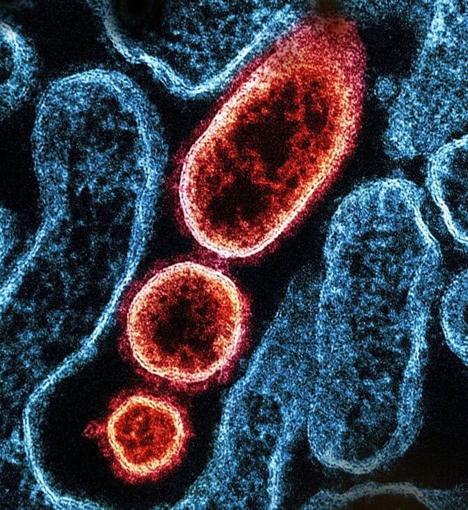 ΙΟΣ ΝΙΠΑ NIPAH 