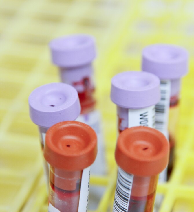 ΗΛΙΚΙΩΜΕΝΟΙ ΑΙΜΑΤΟΛΟΓΙΚΗ ΕΞΕΤΑΣΗ ΕΞΕΤΑΣΗ ΑΙΜΑΤΟΣ