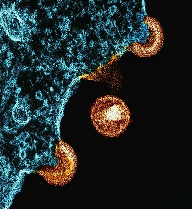 HIV ΘΕΡΑΠΕΙΑ ΧΑΠΙ