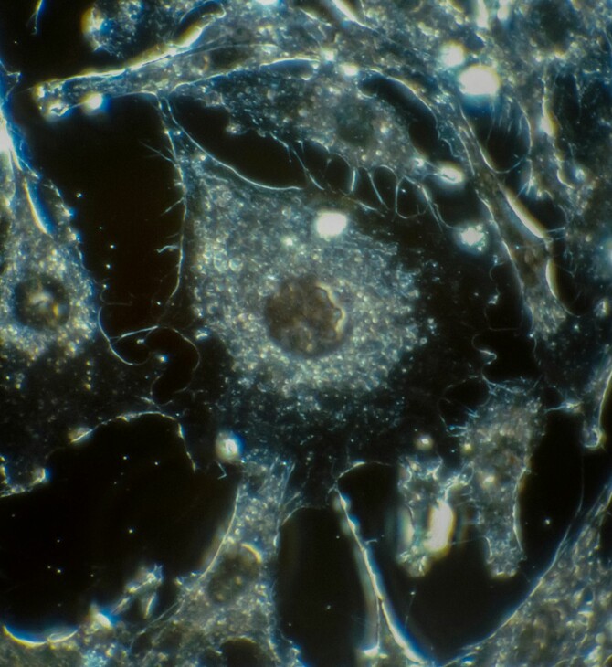 ΚΑΡΚΙΝΟΣ ΠΡΟΣΤΑΤΗ ΘΕΡΑΠΕΙΑ