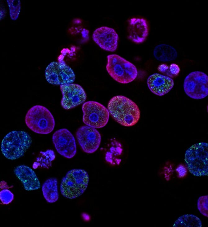 ΚΟΛΟΝΟΣΚΟΠΗΣΗ ΚΑΡΚΙΝΟΣ ΕΝΤΕΡΟ ΠΟΛΥΠΟΔΑΣ