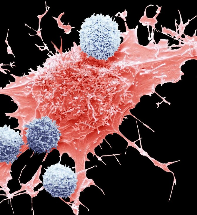 ΚΑΡΚΙΝΟΣ ΠΑΧΕΟΣ ΕΝΤΕΡΟΥ ΤΡΟΦΕΣ