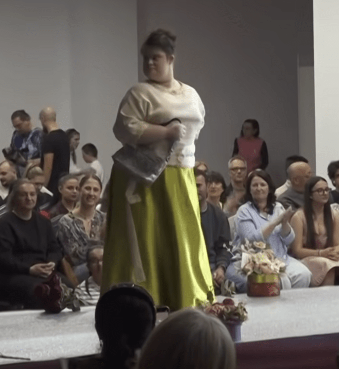 ΣΥΝΔΡΟΜΟ DOWN ΠΑΣΑΡΕΛΑ ΕΠΙΔΕΙΞΗ ΜΟΔΑΣ