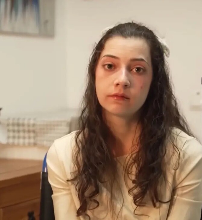 ΕΥΘΑΝΑΣΙΑ ΦΙΛΗ 25ΧΡΟΝΗ ΙΣΠΑΝΙΑ