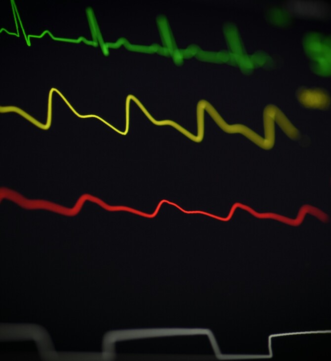 ΚΑΡΔΙΑ ΑΡΡΥΘΜΙΑ ΤΑΧΥΚΑΡΔΙΑ ΕΡΕΥΝΑ