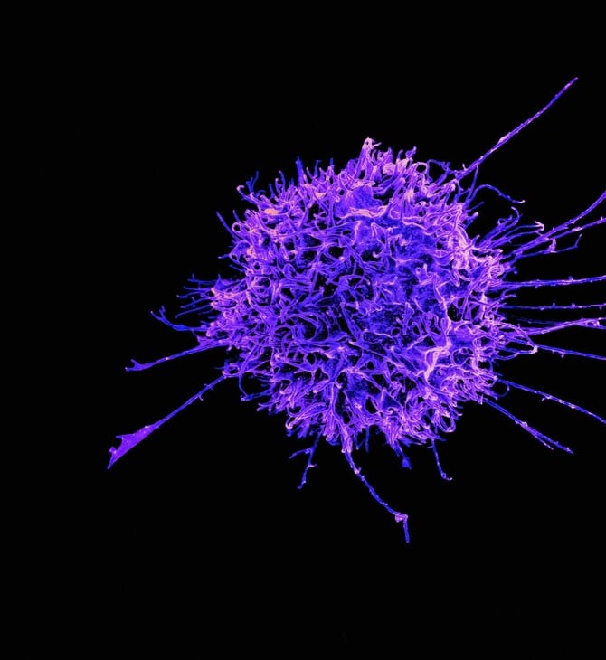 ΕΡΕΥΝΑ ΚΑΡΚΙΝΟΣ ΚΥΤΤΑΡΑ ΓΕΝΕΤΙΚΗ