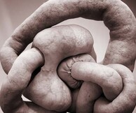 NUDS - SARAH LUCAS