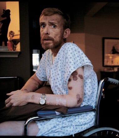 ΠΑΓΚΟΣΜΙΑ ΗΜΕΡΑ AIDS: ΑΥΤΟΙ ΠΟΥ ΔΕΝ ΠΡΟΛΑΒΑΝ