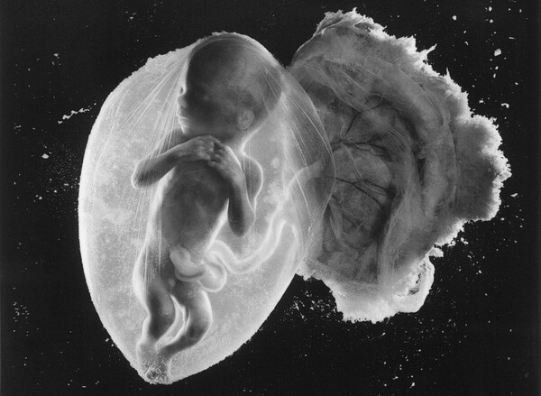 Αυτή είναι η κορυφαία φωτογραφία του περασμένου αιώνα και απεικονίζει ένα έμβρυο 18 εβδομάδων
