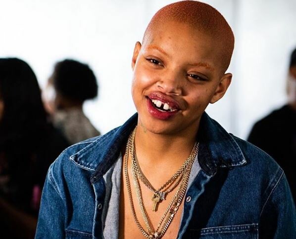 Η «μούσα» της Rihanna αποκάλυψε πως κάνει χημειοθεραπείες: Μην μου συμπεριφέρεστε σαν θύμα