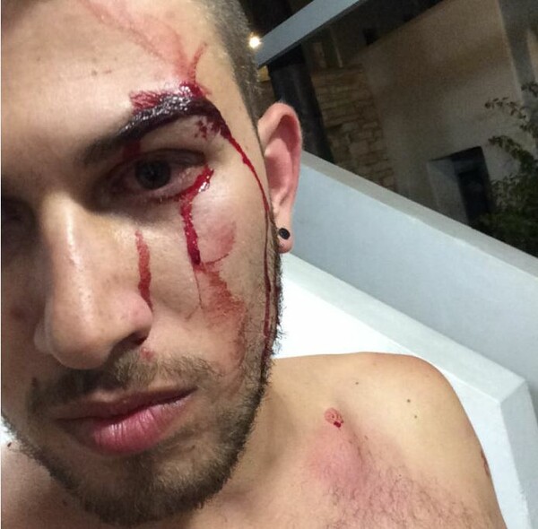 Ομοφοβική επίθεση στην Πάρο από Ιταλούς τουρίστες καταγγέλλει Έλληνας blogger