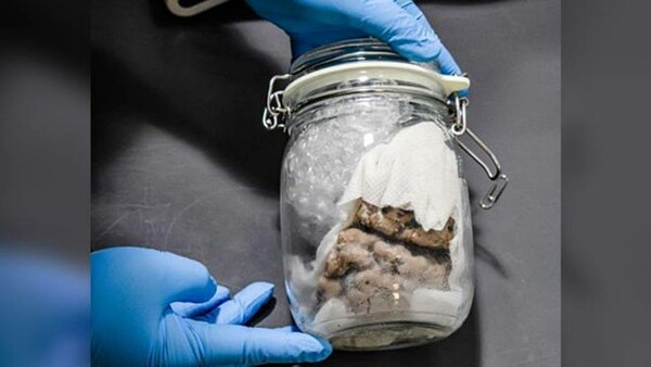 ΗΠΑ: Τελωνειακοί βρήκαν έναν ανθρώπινο εγκέφαλο μέσα σε βάζο