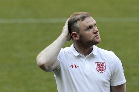 Euro 2012: Αυτή είναι η εμφύτευση μαλλιών για την οποία μιλούν όλοι!