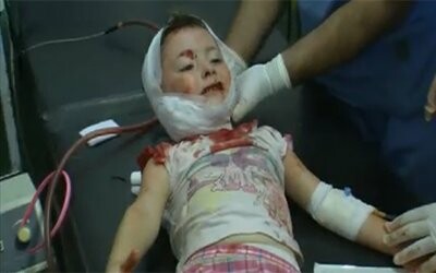Αδέσποτη σφαίρα διαπέρασε το μάγουλο κοριτσιού στο Χαλέπι