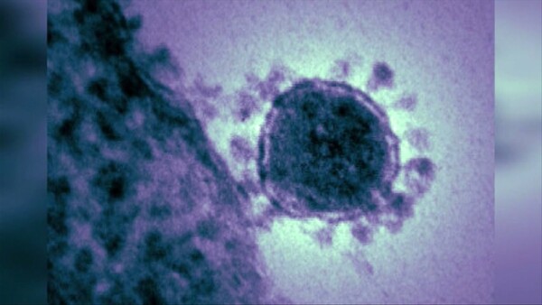 Θερίζει ακόμα ο ιός MERS στη Σαουδική Αραβία