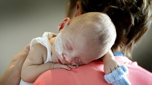 Στην Αυστραλία γεννήθηκε το μικρότερο μωρό που κατάφερε να ζήσει