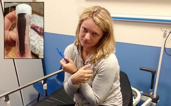 Βρετανία: 24χρονη ζούσε με μια βδέλλα στη μύτη