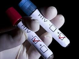 ΟΗΕ για τον HIV: Οι άνδρες με ερωτικούς συντρόφους του ιδίου φύλου έχουν 28 φορές περισσότερες πιθανότητες να προσβληθούν από τον ιό