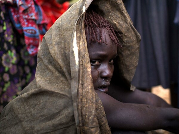 UNICEF: Πάνω από 200 εκατ. κορίτσια και γυναίκες σε όλο τον κόσμο υπέστησαν πέρυσι κλειτοριδεκτομή