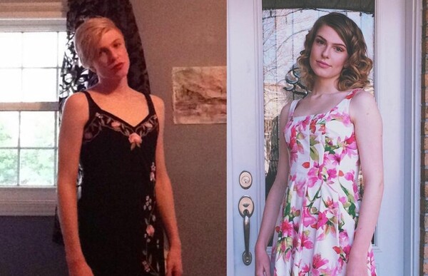Transgender άτομα μοιράζονται με υπερηφάνεια φωτογραφίες τους "πριν & μετά" την μετάβαση