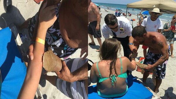 HΠΑ: Γυναίκα μεταφέρθηκε για τις πρώτες βοήθειες με ένα μικρό καρχαρία "καρφωμένο" στο χέρι της