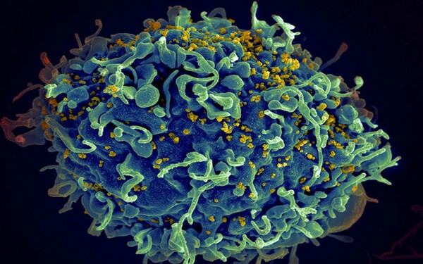Νέες ελπίδες για την καταπολέμηση του HIV