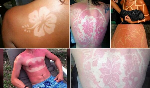 Οι ειδικοί προειδοποιούν για τη μόδα με τατουάζ από ηλιακά εγκαύματα