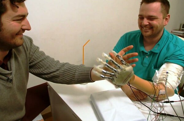 Βιονικό χέρι μεταδίδει την αίσθηση της αφής σε πραγματικό χρόνο