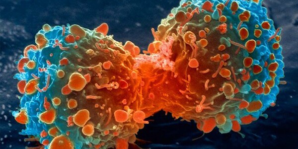 Αμφισβητείται η δράση των αντιοξειδωτικών συμπληρωμάτων κατά του καρκίνου