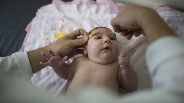 Γεννήθηκε το πρώτο μωρό στην Ευρώπη με μικροκεφαλία από τον Ζίκα