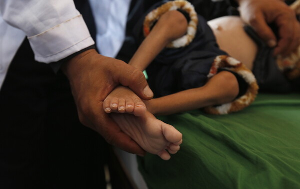 Κίνδυνος λιμού για εκατομμύρια ανθρώπους στην Υεμένη, προειδοποιεί ο ΟΗΕ