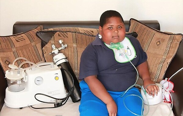 Πέθανε ο 11χρονος που έτρωγε χαρτί υγείας και λάσπη λόγω μιας σπάνιας ασθένειας