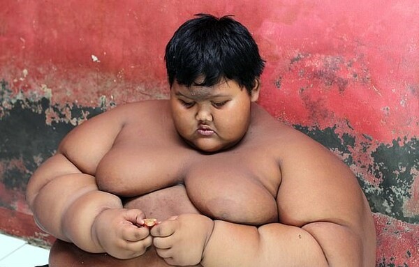 Το πιο παχύσαρκο παιδί στον κόσμο έχει χάσει ήδη το μισό βάρος του και θέλει να γίνει ποδοσφαιριστής