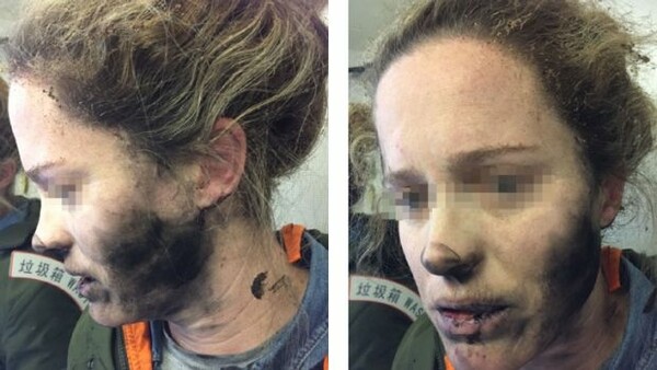 Γυναίκα επιβάτης σε πτήση με εγκαύματα στο πρόσωπο από έκρηξη ακουστικών με μπαταρίες