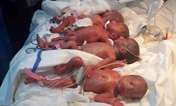 Σπάνια περίπτωση - Μια 25χρονη γέννησε με φυσικό τοκετό επτάδυμα σε νοσοκομείο του Ιράκ