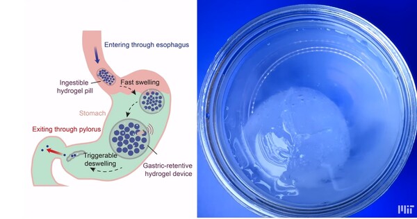 Επιστήμονες ανακάλυψαν το έξυπνο χάπι που φουσκώνει σαν μπαλάκι στο στομάχι
