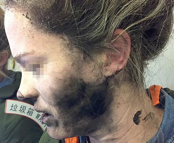 Γυναίκα επιβάτης σε πτήση με εγκαύματα στο πρόσωπο από έκρηξη ακουστικών με μπαταρίες