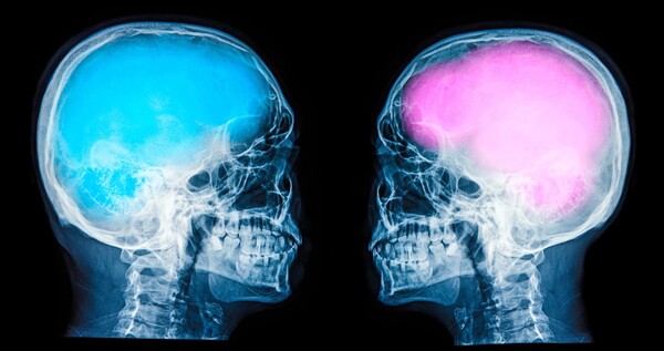 Υπάρχει γυναικείος και ανδρικός εγκέφαλος ή μόνο «unisex»; Επιστήμονες απαντούν