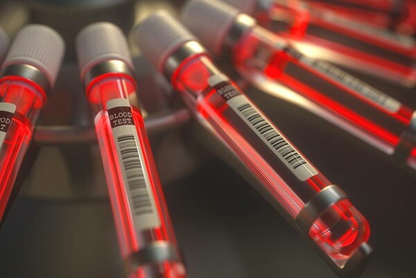 Δωρεάν οι γενετικές εξετάσεις σε καρκινοπαθείς μέσω του Δικτύου Ιατρικής Ακριβείας