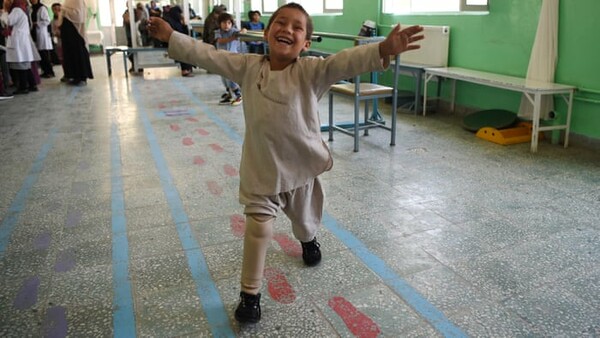 Συγκινεί ο πεντάχρονος Αφγανός που έχασε το πόδι και χορεύει με το προσθετικό μέλος που απέκτησε
