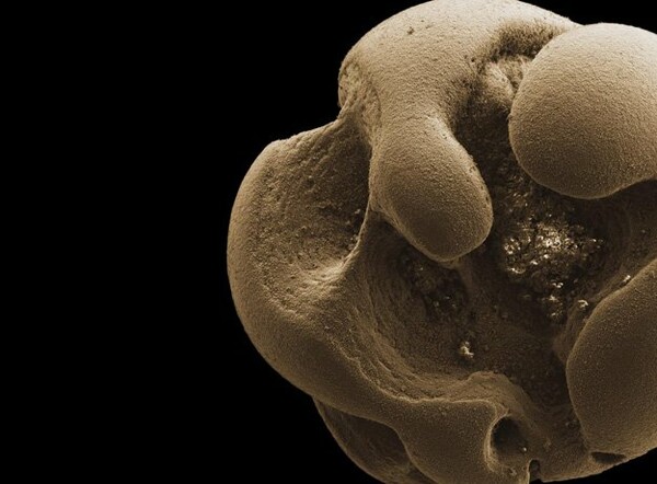 Βακτήριο που τρέφεται από μέταλλο ανακάλυψαν τυχαία οι επιστήμονες
