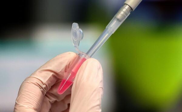 Κορωνοϊός: Η Ρωσία απαντά στην κριτική για το εμβόλιο - «Αβάσιμες ανησυχίες»