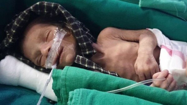 Έθαβε την κόρη του και βρήκε ζωντανό νεογέννητο κορίτσι σε τάφο - Οι σοκαριστικές βρεφοκτονίες στην Ινδία