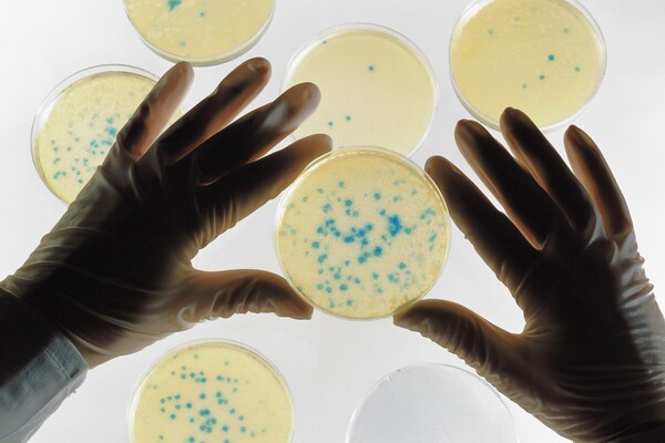 Βακτήριο που ίσως πολεμήσει το παγκόσμιο πρόβλημα του πλαστικού, ανακαλύφθηκε τυχαία από φοιτήτρια