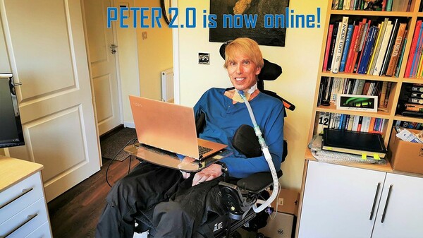 Peter Morgan-Scott: Η ιστορία ενός ανθρώπου που θέλει να γίνει cyborg