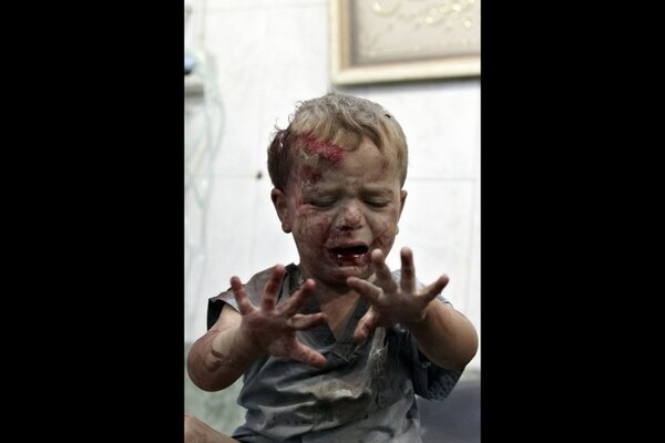 40 συγκλονιστικές φωτογραφίες: Αίμα και Χάος στη Συρία 