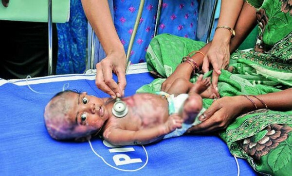 Aυτό το μωρό ''αυταναφλέγεται'' και οι γιατροί έχουν πραγματικά μπερδευτεί (video)
