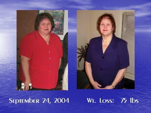 Φωτογραφίες ατόμων πριν και μετά την απώλεια βάρους