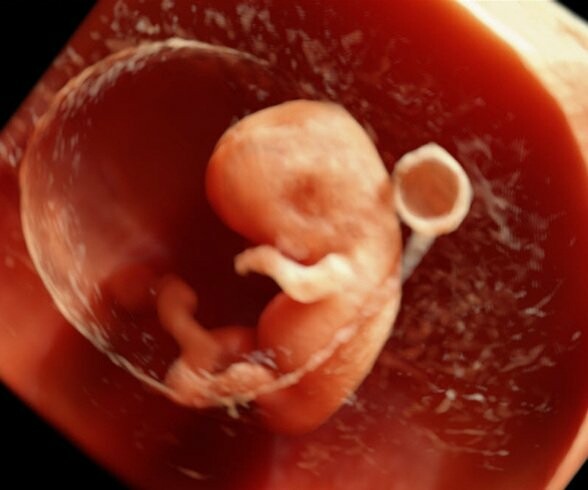 Τρισδιάστατα HD έμβρυα μέσα από την κοιλιά της μητέρας τους