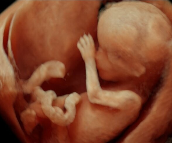 Τρισδιάστατα HD έμβρυα μέσα από την κοιλιά της μητέρας τους